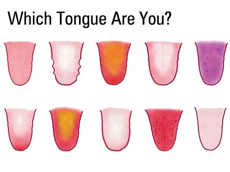 Basic Tongue Diagnosis Acumedic Clinic
