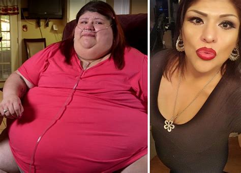 20 Incredible Before And After Photos From My 600 Lb
