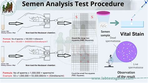 Semen Analysis Test Procedure Lab Tests Guide