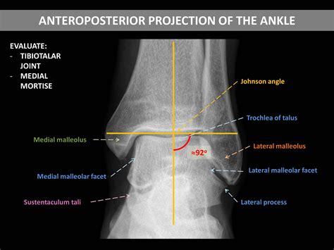 Anatomy Of The Medial Ankle