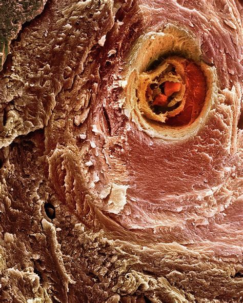 Mammalian Bone Photograph By Dennis Kunkel Microscopyscience Photo Library