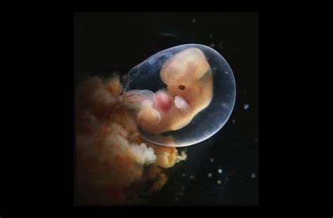 Pictures Of Unborn Babies At Different Stages Of Development In The
