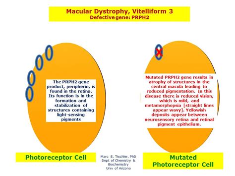 Macular Dystrophy Vitelliform 3 Hereditary Ocular Diseases