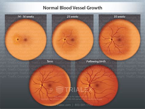 Normal Blood Vessel Growth Trialexhibits Inc