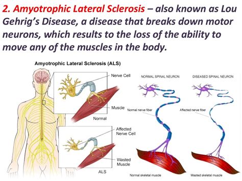 Disorder Of The Nervous System