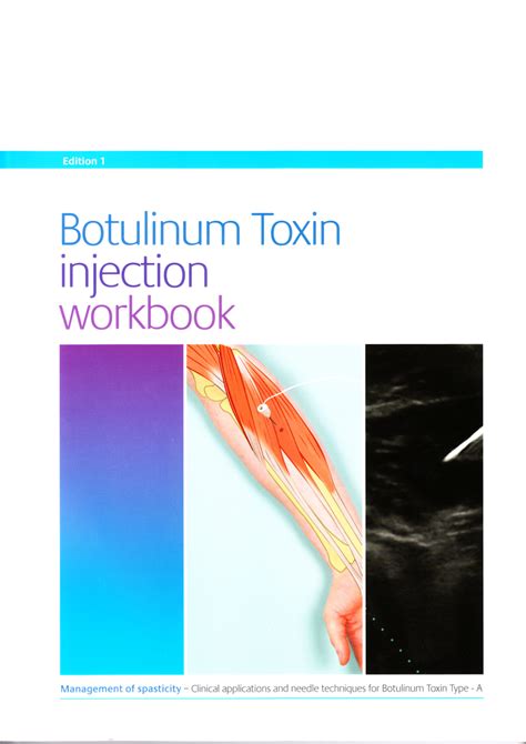 Pdf Botulinum Toxin Injection Workbook Spasticity Clinical