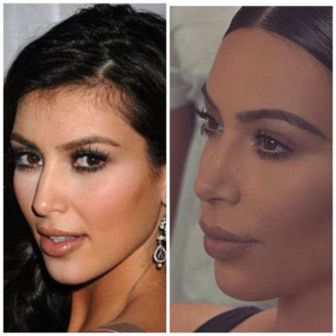 Kim Kardashian Nose Job Nose Job Plastic Surgery Kim Kardashian Make