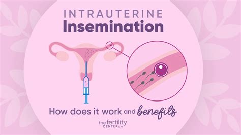 Intrauterine Insemination How Does It Work And Benefits The Fertility Center Youtube