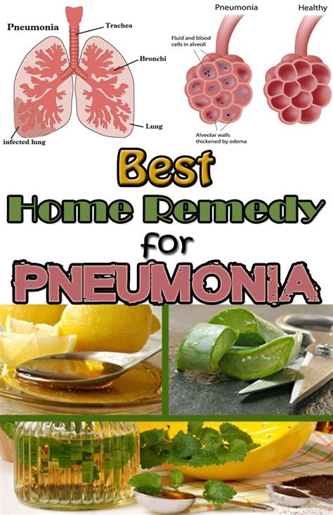 Best Home Remedy For Pneumonia Home Remedies