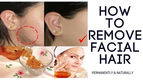 They live in canals full of. How to remove Facial Hair Permanently - 100% Works ...