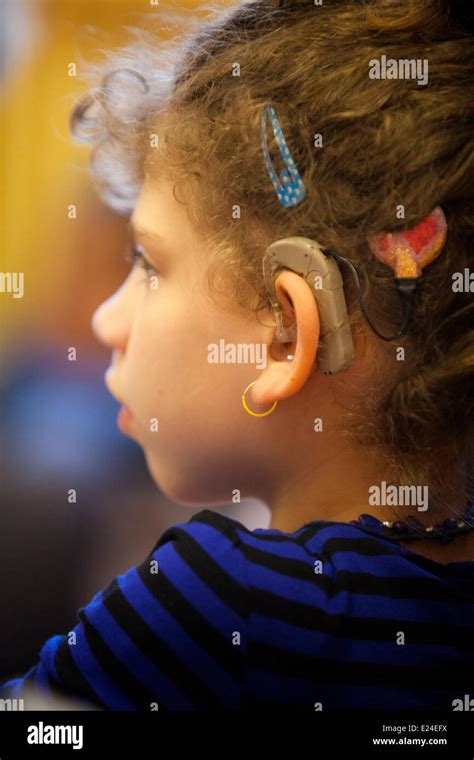 Child Hearing Aid Hi Res Stock Photography And Images Alamy
