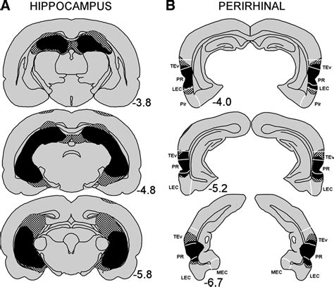 Hippocampus Perirhinal Cortex And Complex Visual Discriminations In