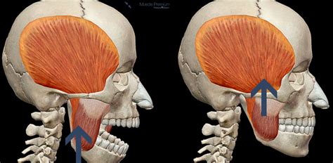 Learn Muscle Anatomy Muscles Of Mastication