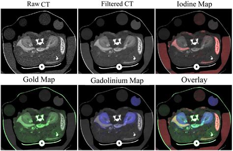 Computerized tomography (ct scan) is a procedure that assists in diagnosing tumors, fractures, bony structures, and infections in the organs and tissues of the body. Frontiers | In vivo small animal micro-CT using ...