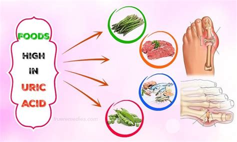 10 Gout Causing Foods High In Uric Acid To Avoid