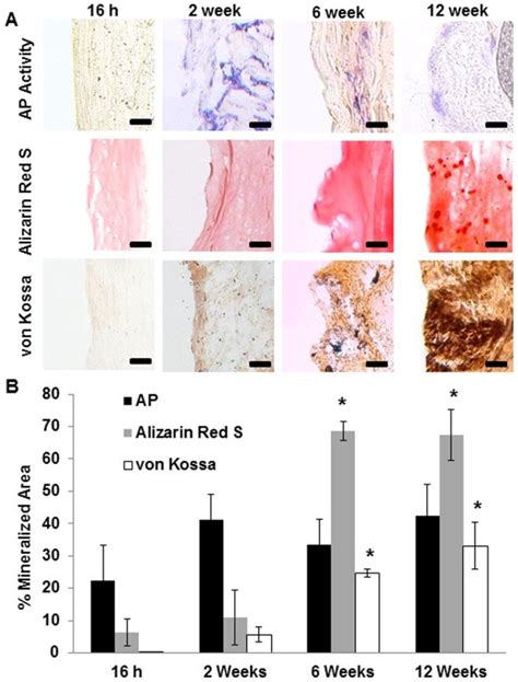 Alkaline Phosphatase Ap Assay And Calcification Staining Of Implanted