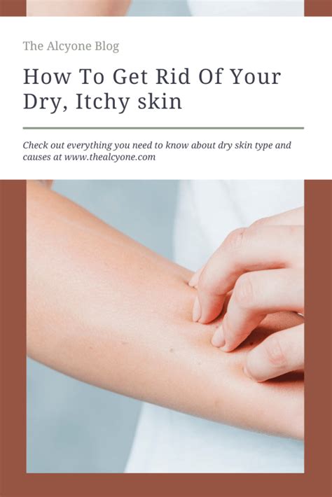 Dry Skin Causes And How To Get Rid Of Dry Skin