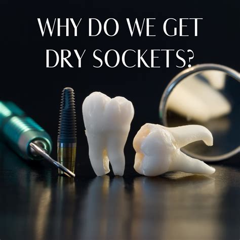 Why Do We Get Dry Sockets And How Do We Treat Them All Out Wisdom Teeth