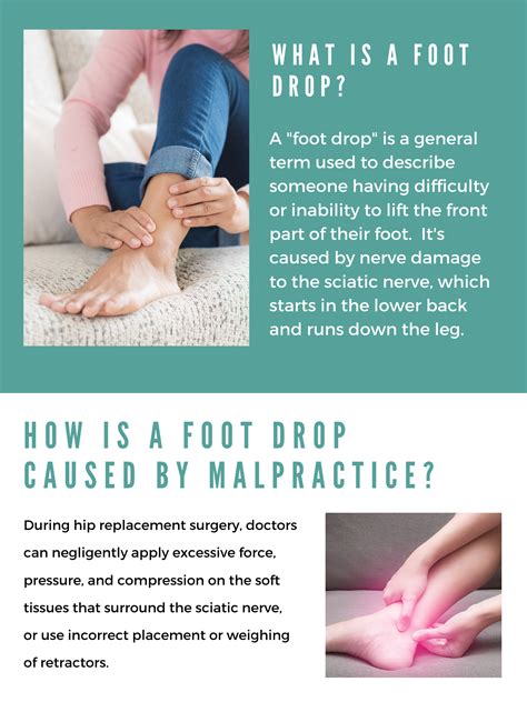What Is Foot Drop Kienitvcacke