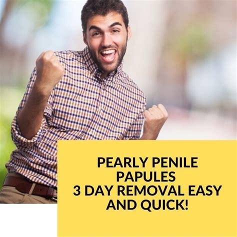 Pin On Pearly Penile Papules Removal Easy And Quickly