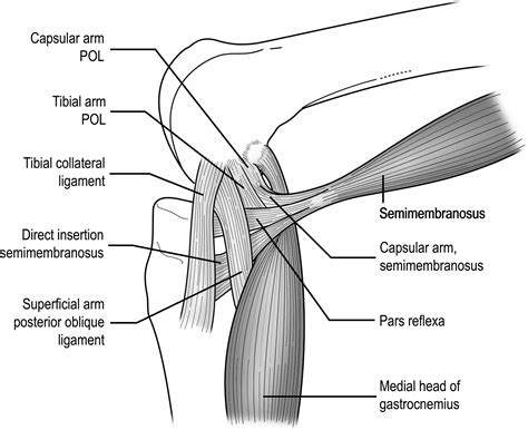 Posteromedial Corner Injuries Of The Knee Clinical Radiology