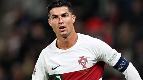 Ronaldo Bloodied In Portugal Match After Brutal Collision With Czech
