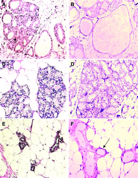 Morphological Changes In Mammary Gland Of Rats Treated For 2 Years With