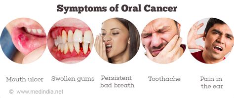 Oral Cancer Symptoms Warning Signs