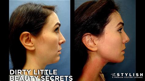 Plastic Surgery Neck Lift Cost Lift Choices