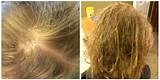 Photos of What Treatment Is Good For Dry Damaged Hair