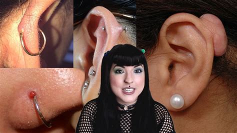 What Are Those Bumps On Your Piercings And How To Get Rid Of Them Piercer Explains Youtube