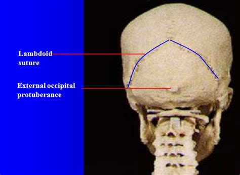 They don't move and united into a single unit. MBBS Medicine (Humanity First): Skull Anatomy