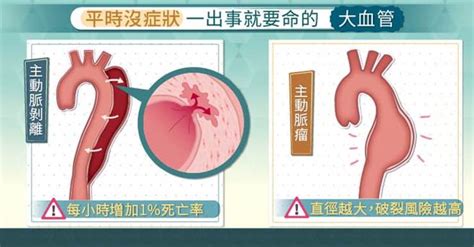 1,804,577 likes · 3,145 talking about this. 你也是「間歇性跛腳」族嗎？ 醫：恐已周邊動脈阻塞 - 健康 - 中時新聞網