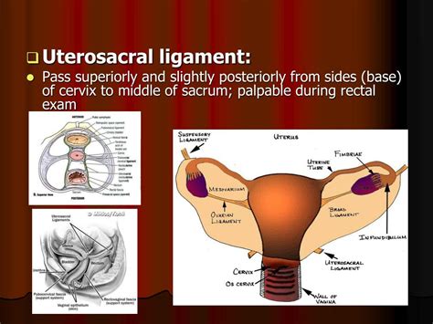 ppt genital prolapse powerpoint presentation free download id 737997