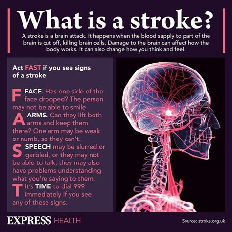 Stroke Blood Clots Account For 80 Per Cent Of Cases Are You At Risk