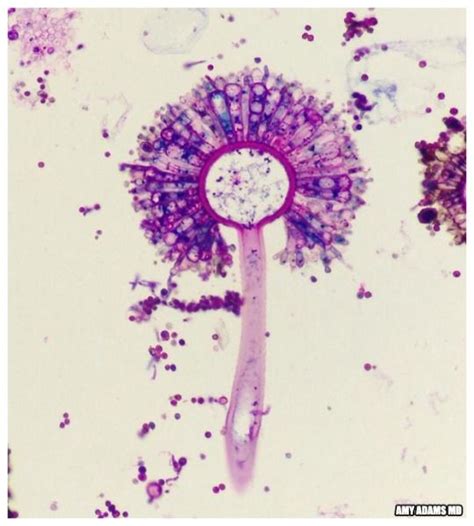 Aspergillus Fumigatus V A Dandelion Microscopic Photography Medical