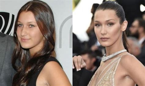 bella hadid nose job before and after bella hadid nose celebrities