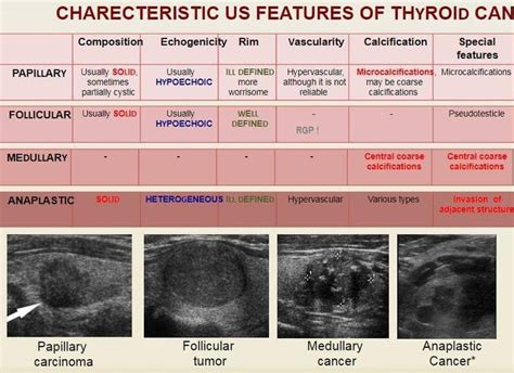 118 Best EcografÍa Tiroidea Images On Pinterest Thyroid Ultrasound