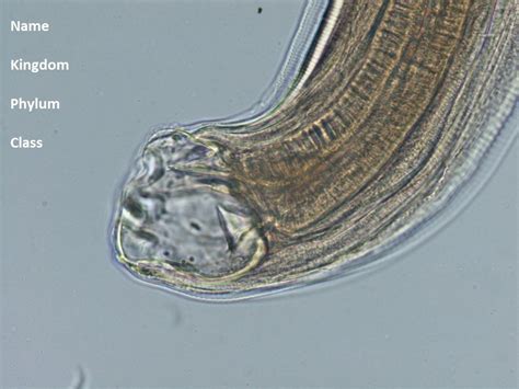 Necator Americanus Diagram Quizlet