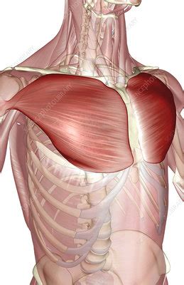 After a discussion with the patient about her treatment options, she elected for surgical repair of the pectoralis major tendon. Pectoralis major - Stock Image - F002/0362 - Science Photo ...