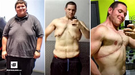 400 pound man has to start over after skin surgery jordan grahm s transformation spotlight