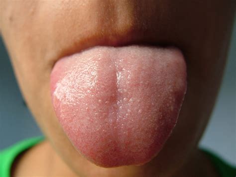 Spit It Out 4 Things Saliva Reveals About Your Health Jagwire