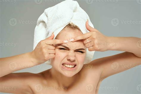 Pretty Woman With Towel On Her Head Squeezes Out Pimples On Her Face