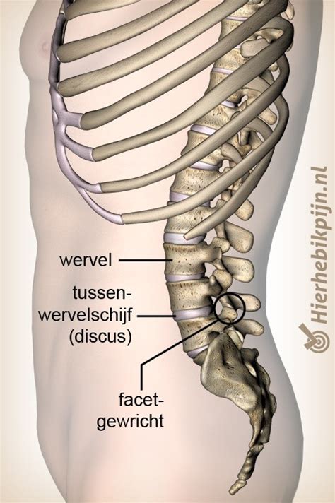 Hernia L L Symptomen Symptomen