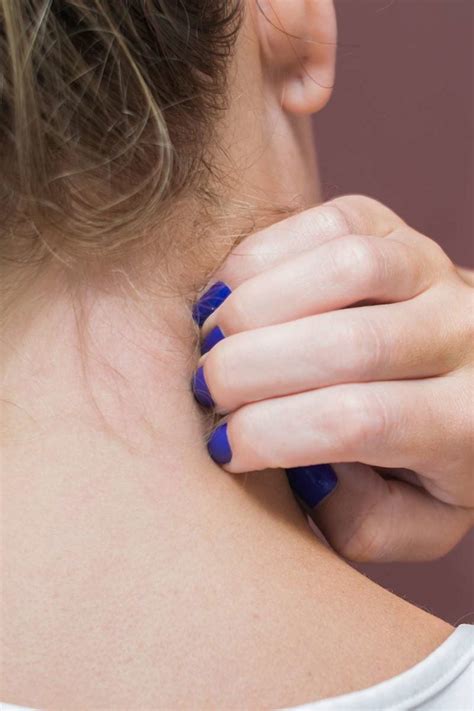 Itchy Neck Causes Remedies And Prevention