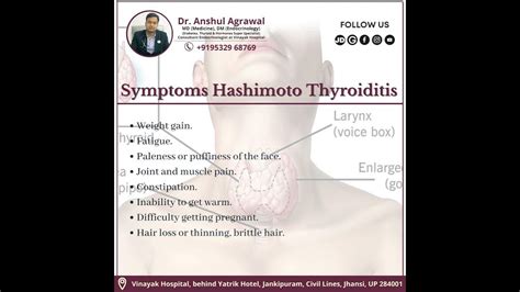 Dr Anshul Agrawal Endocrinologist In Jhansi Diabetes Doctor In