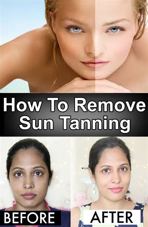 How To Remove Sun Tanning Skin Tan Removal Face Skin Care Sun Tan