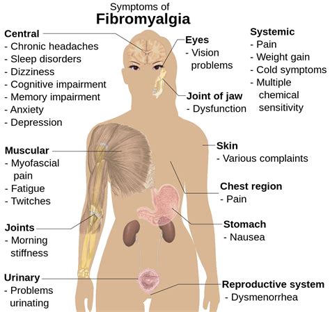 Manage Your Pain Of Fibromyalgia With Massage Therapy Sunstone Registered Massage Therapy