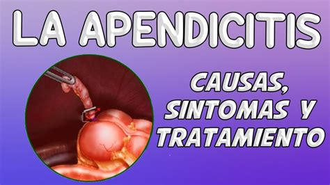 Apendicitis S Ntomas Causas Y Tratamiento Iocir The Best Porn Website