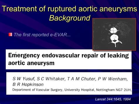 Endovascular Repair Of Traumatic Aortic Transection Six Years Of Experience